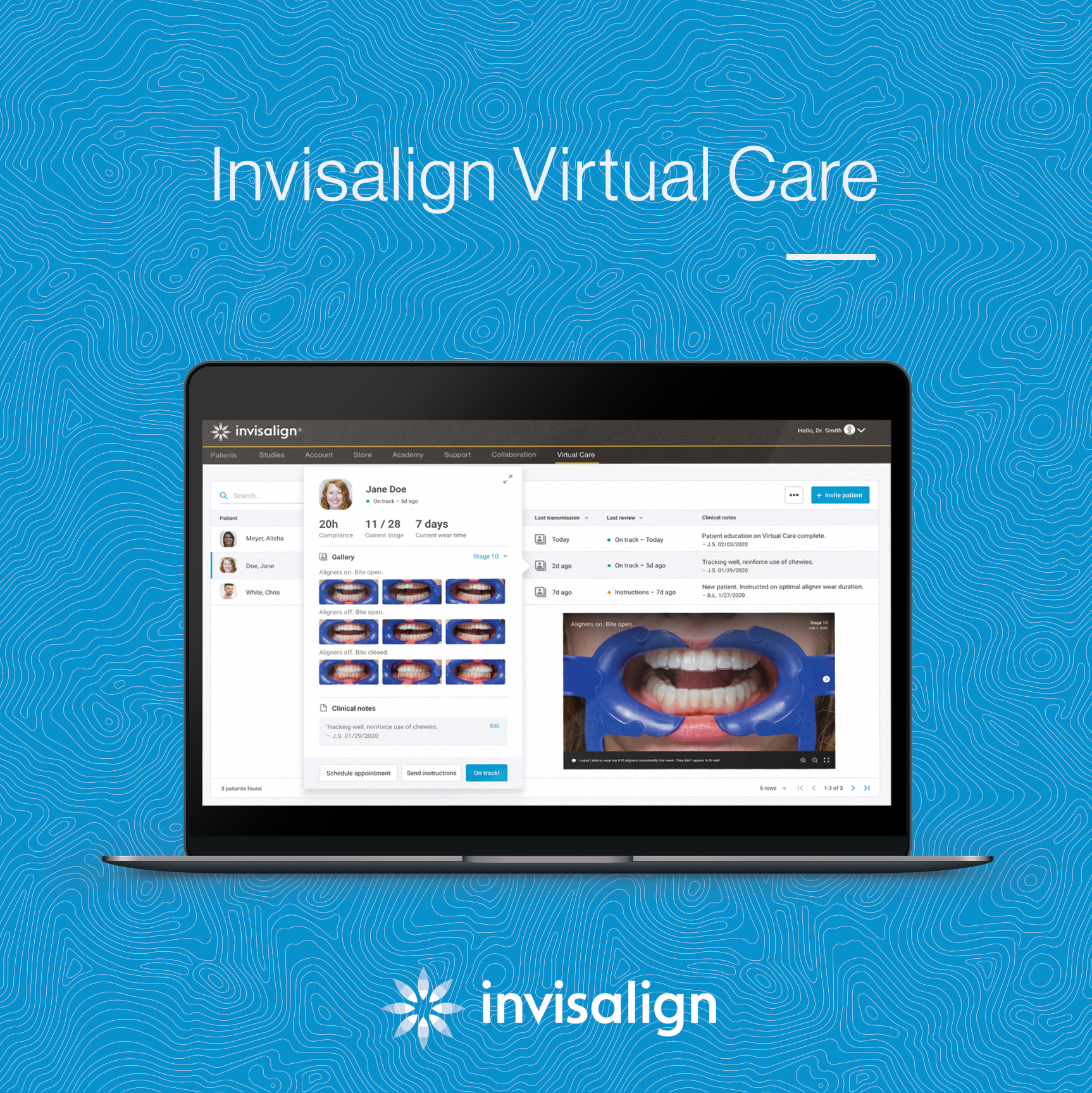 Invisalign_April_5 Invisalign_April_5